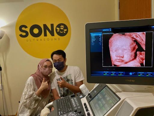 SONOBEE ULTRASOUND JENJAROM
